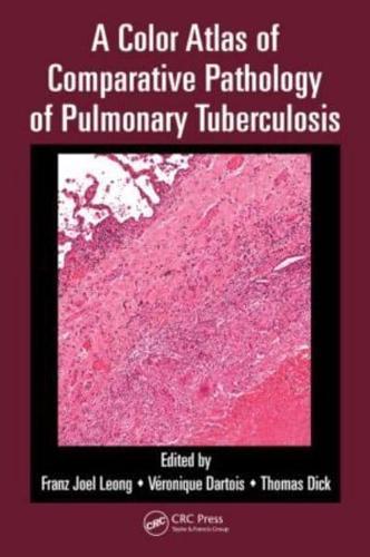 A Color Atlas of Comparative Pathology of Pulmonary Tuberculosis                                                                                      <br><span class="capt-avtor"> By:Dick, Thomas                                      </span><br><span class="capt-pari"> Eur:113,80 Мкд:6999</span>